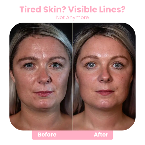 Wrinkl™ Smooth Stick